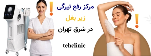 مرکز رفع تیرگی زیر بغل در شرق تهران