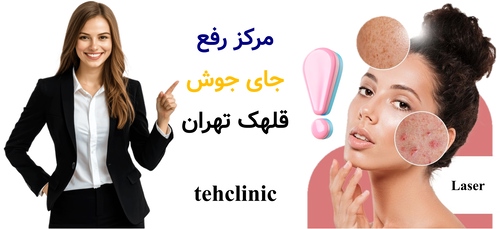 مرکز رفع جای جوش قلهک تهران