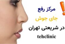 مرکز رفع جای جوش در شریعتی تهران