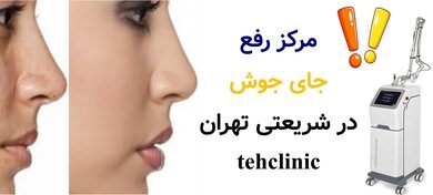 مرکز رفع جای جوش در شریعتی تهران