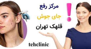 مرکز رفع جای جوش قلهک تهران