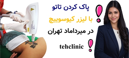 پاک کردن تاتو با لیزر کیوسوییچ در میرداماد تهران