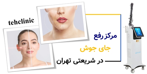 مرکز رفع جای جوش در شریعتی تهران