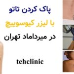پاک کردن تاتو با لیزر کیوسوییچ در میرداماد تهران