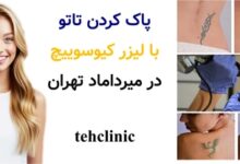 پاک کردن تاتو با لیزر کیوسوییچ در میرداماد تهران