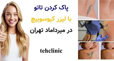 پاک کردن تاتو با لیزر کیوسوییچ در میرداماد تهران