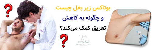 بوتاکس زیر بغل چیست و چگونه به کاهش تعریق کمک می‌کند؟
