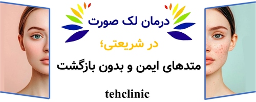 درمان لک صورت در شریعتی؛ متدهای ایمن و بدون بازگشت