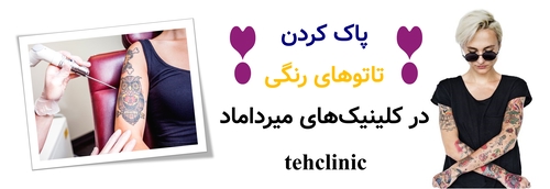 پاک کردن تاتوهای رنگی در کلینیکهای میرداماد