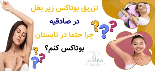 تزریق بوتاکس زیر بغل در صادقیه : چرا حتما در تابستان بوتاکس کنم ؟